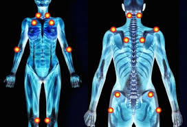 Bowen Therapy Fibromyalgia Relief Treatment Collingwood, On