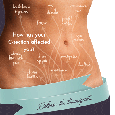 Raindrop Therapy Technique Lymphatic Drainage Collingwood