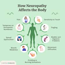 Bowen Therapy Neuropathy Pain Relief Treatment Collingwood